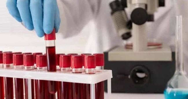 Onların qanı da qızıldandır: Problemlər bitəcək?