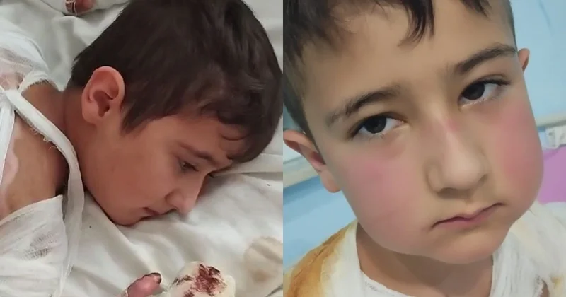 Yeddi yaşlı Ümidin yardımsevər şəxslərin dəstəyinə ehtiyacı var