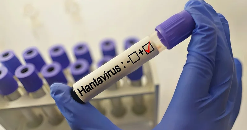 Hantaviruslu kruiz gəmisinin sıfır xəstə si məlum olub