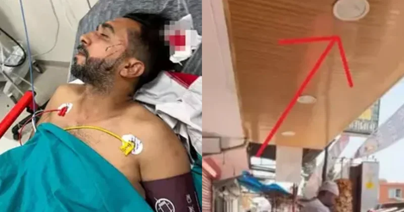 Türkiyədə qəribə hadisə: Dönər yeyən şəxsin başına kafenin tavanından güllə dəydi