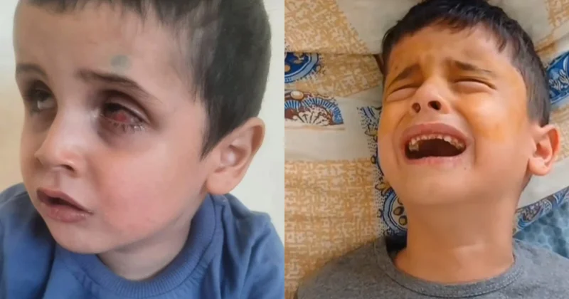 Gözləri görməyən Ömərin anası balası üçün yalvarır: O qədər yıxılıb, ayaqları, əlləri də yara olub