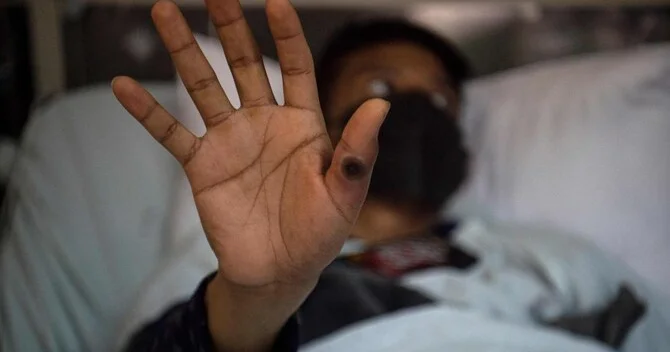 Yeni virus kabusu: Vəziyyət kritikdir