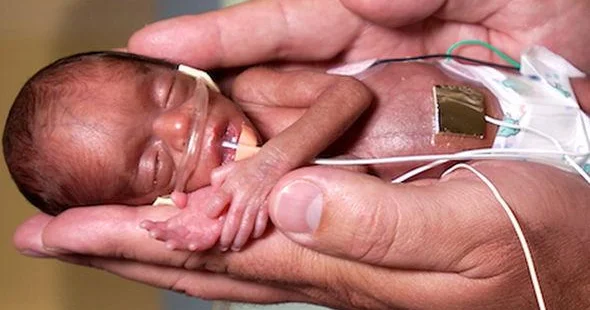 Selektiv abortların mədəni kökü: Problem ultrasəs cihazında yox, beyinlərimizdədir