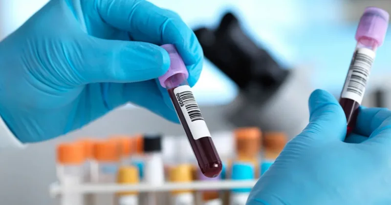 Hepatit C ilə mübarizədə tarixi nəticə: İngiltərə hədəfə vaxtından əvvəl çatıb
