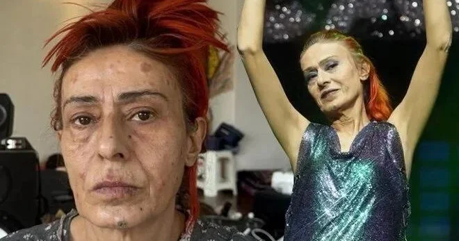 Yıldız Tilbə son fotosu ilə pərəstişkarlarını qorxudub