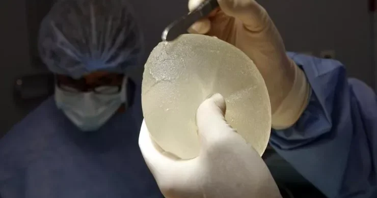 Polis qadın döş implantının çıxarılmasından sonra öldü: Faciənin TƏFƏRRÜATLARI