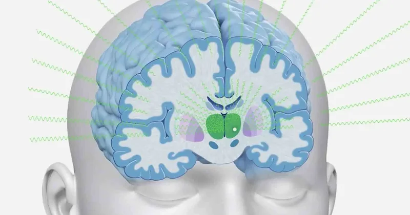 Создана ультразвуковая терапия для защиты мозга от последствий инсультов