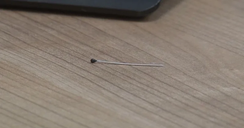 2 yaşlı uşağın bağırsağında iynə tapıldı FOTO