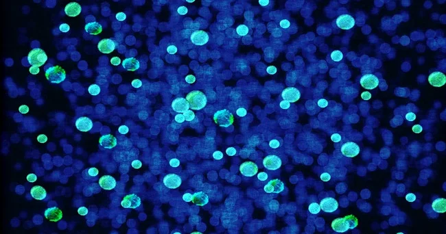 Təhlükəli hissəciklər hər yerdə: Mikroplastiklərdən özünüzü necə qorumalı