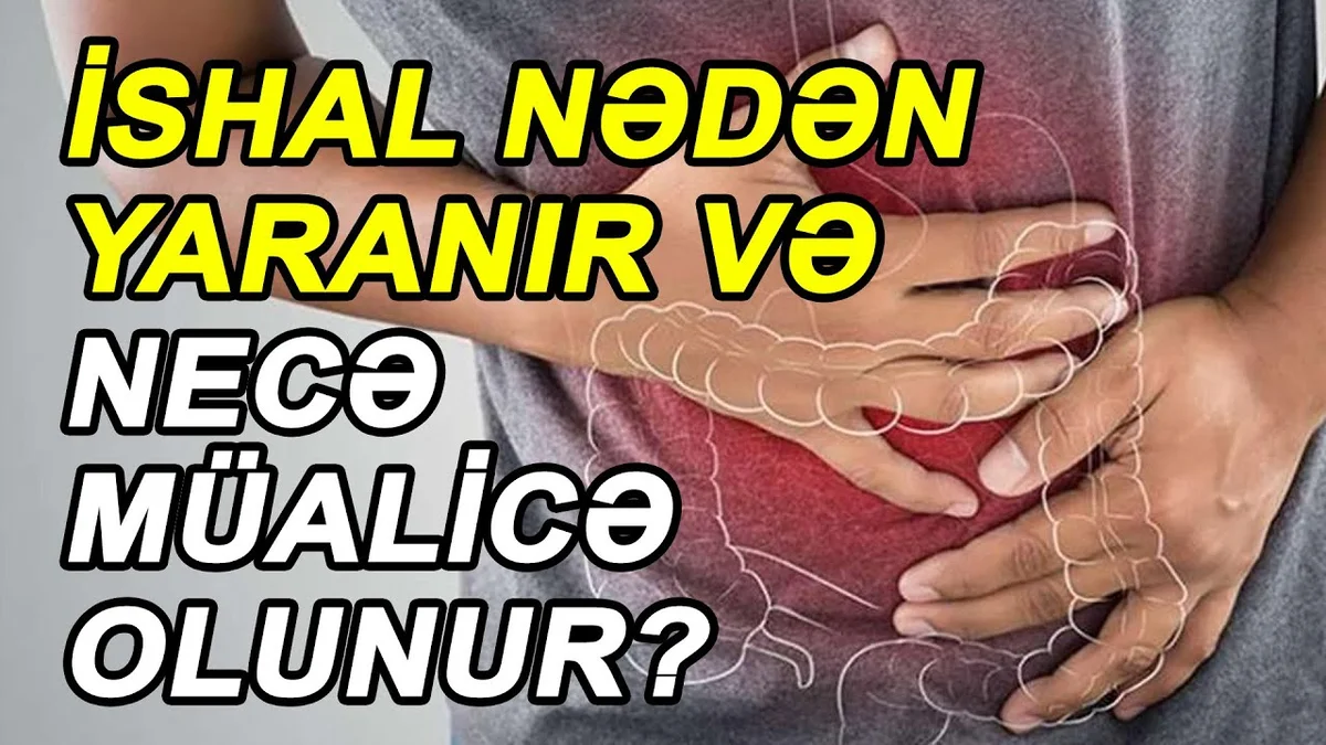 İshal nədən yaranır və necə müalicə olunur?