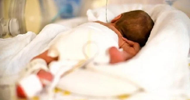 Fotoşəkillə körpələrdə sarılıq xəstəliyi müəyyən oluna bilər