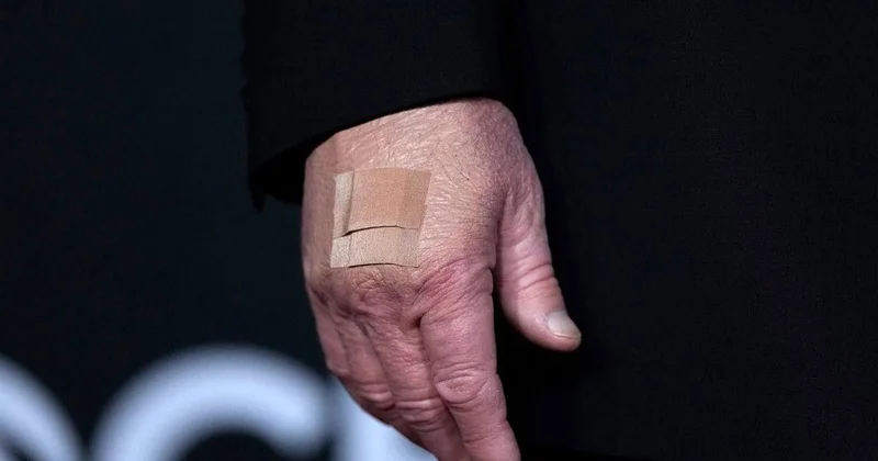 Белый дом объяснил наличие синяка и пластыря на запястье Трампа Minval Politika