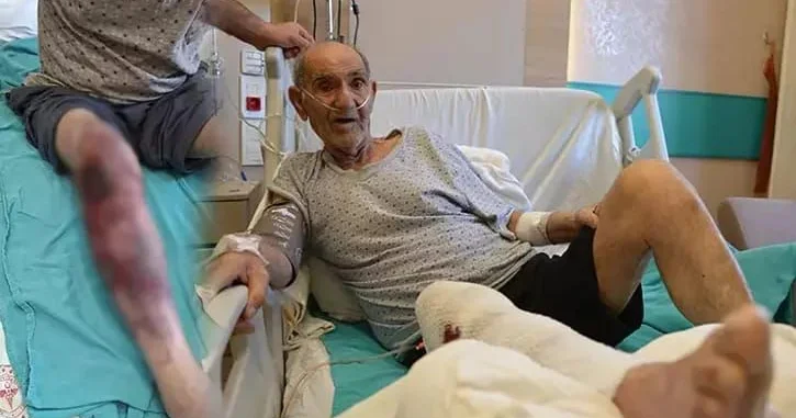 Təmizləyicisi vasitə ayağını yandırdı Xəstəxanalıq oldu FOTO