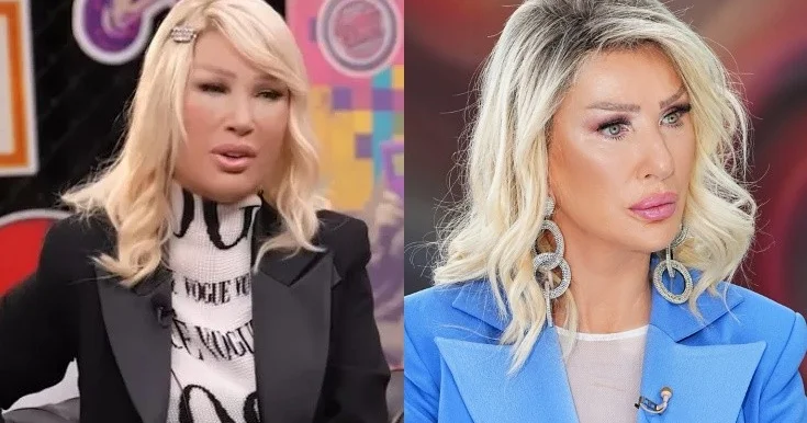 Seda Sayan estetik prosedurlardan sonra Fotolar