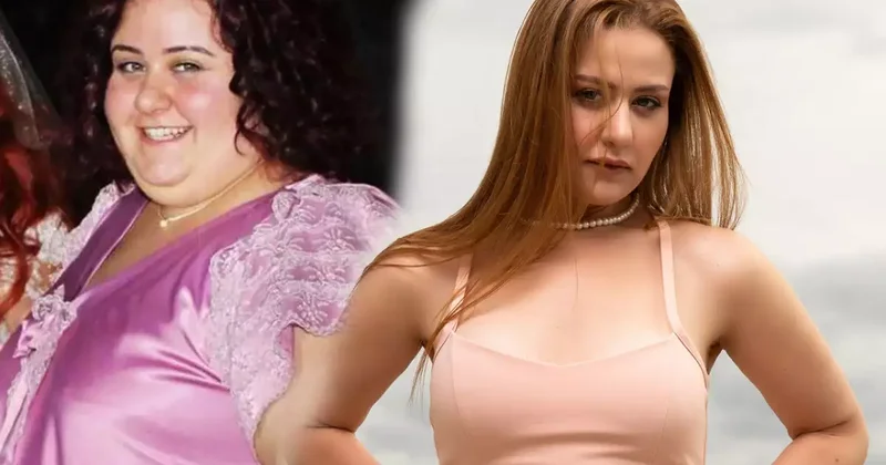 “Hercai”nin aktrisası 110 kiloqram arıqladı