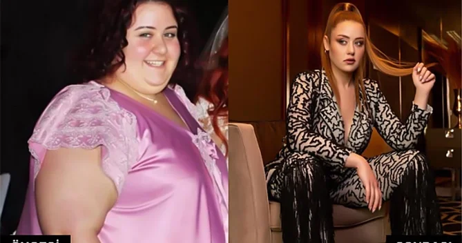 110 kiloqram arıqlayan aktrisanın SON HALI