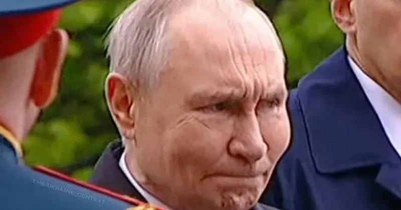 Putinin üzündəki şişkinlik: Xəstəlik, yoxsa botoks?