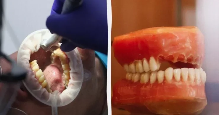 Əlvida, implantlar: Yeni dişlərin çıxması üçün dərman sınaqları başladı