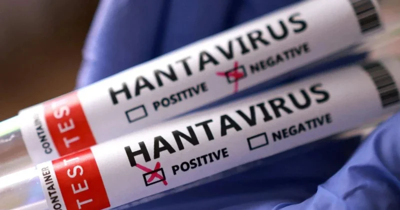 Hantavirus Ukraynaya çatdı Ölənlər var