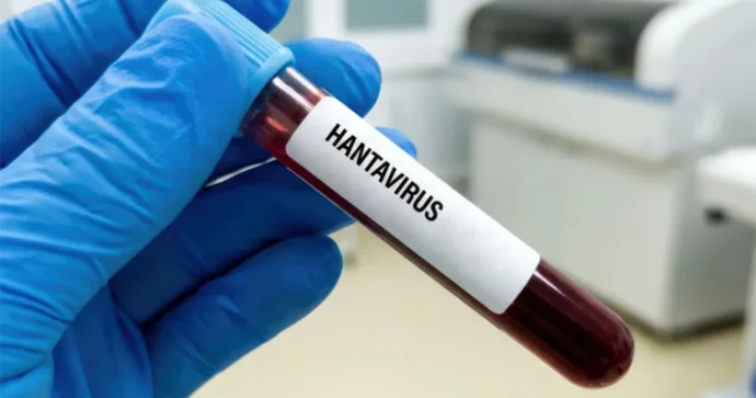 Hantavirus insandan insana nadir halda keçir Rəsmi