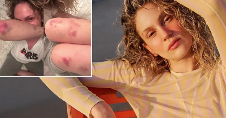 Farah Zeynep Abdullaha nə olub? Foto