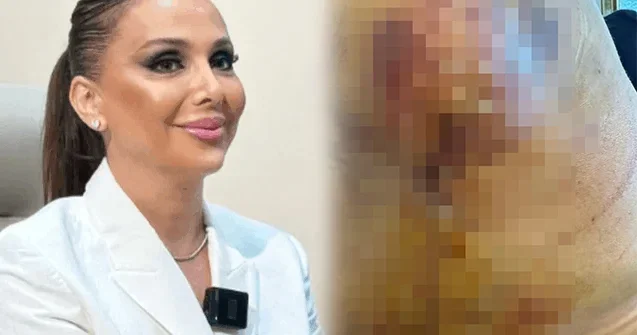 “Həkim məni 3 dəfə əməliyyat edib pis vəziyyətə qoydu” Foto