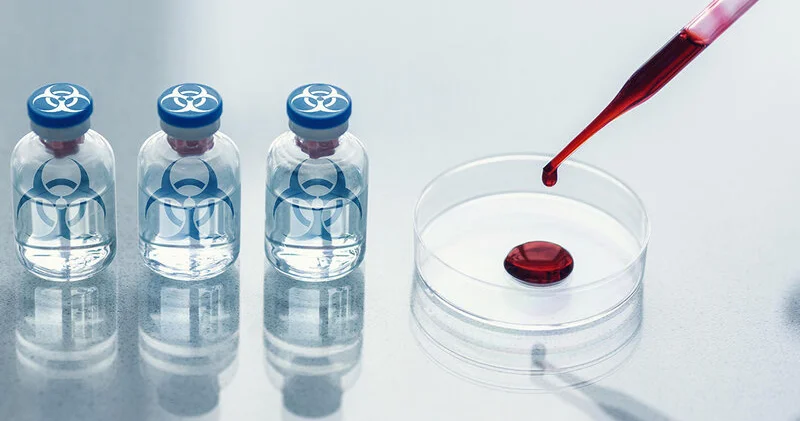 ABŞ Milli Kəşfiyyatı indiyə qədər gizlədilən bioloji laboratoriyaların sayını açıqladı
