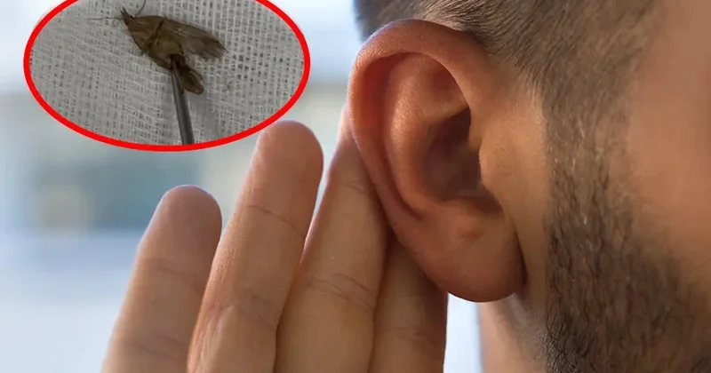 40 yaşlı kişinin qulağından kəpənək çıxarıldı, təbiətə buraxıldı