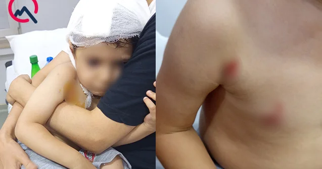 Masazırda 2 yaşlı uşağı it dişlədi Fotolar