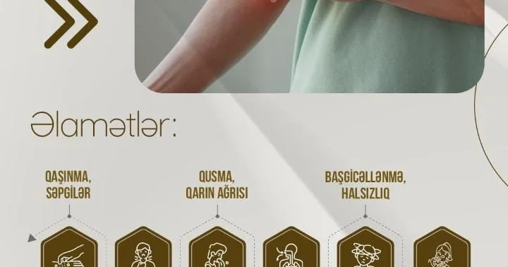 Qida allergiyaları ilə bağlı məlumatlılığın artması müraciətlərin sayını artırıb EKSPERT
