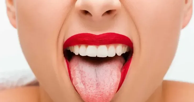Dil vasitəsilə hansı xəstəlikləri “diaqnoz” etmək olar?