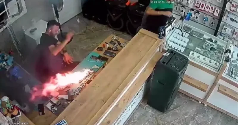 Telefonun batareyası partladı, adam alışdı FOTO KONKRET