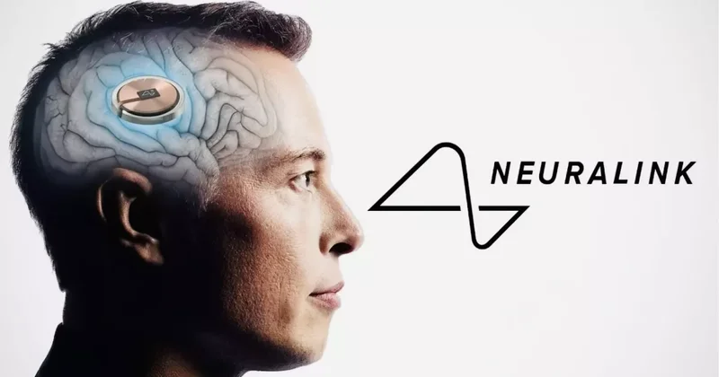 Растет число желающих вживить в себя имплант Neuralink