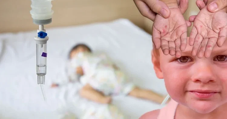 Sürətlə yayılan xəstəlik: Yüksək hərarət və səpgilərə diqqət