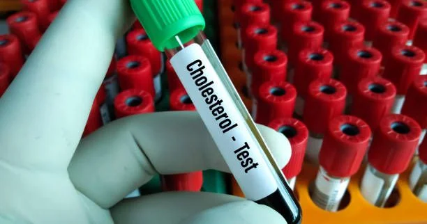 Xolesterol haqqında gözardı olunmamalı 4 əsas fakt