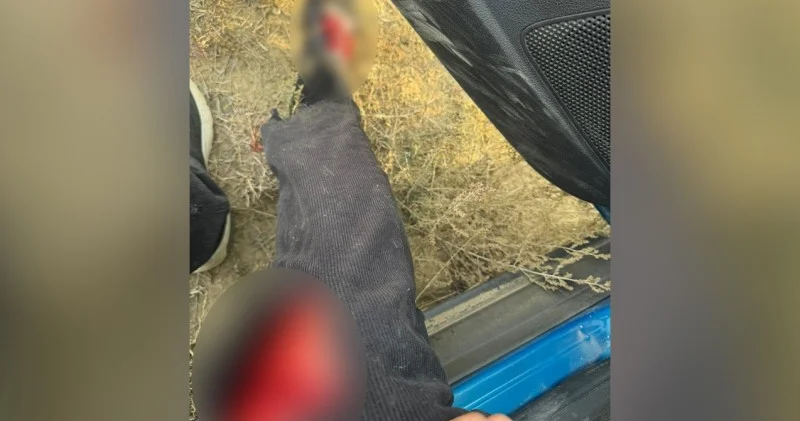 AzTV nin müxbiri xəsarət aldı FOTO