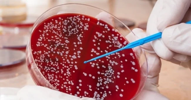 Xərçəngin şirin İzi: Minlərlə insanın həyatı xilas olacaq