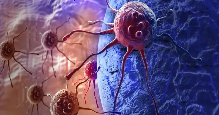 Xərçəngdən ölüm sayı 2050 ci ilə qədər ikiqat artacaq Araşdırma