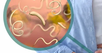 Qurd xəstəliyinin hansı gözlənilməz simptomları olur?