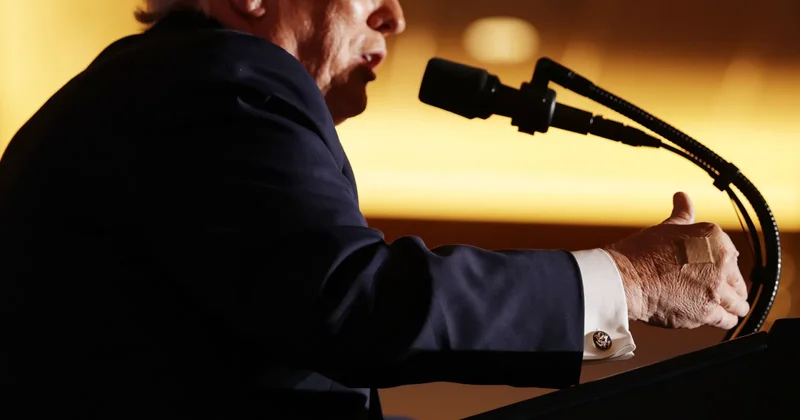 “Trampın əli çox salamlaşmaqdan göyərib” FOTO