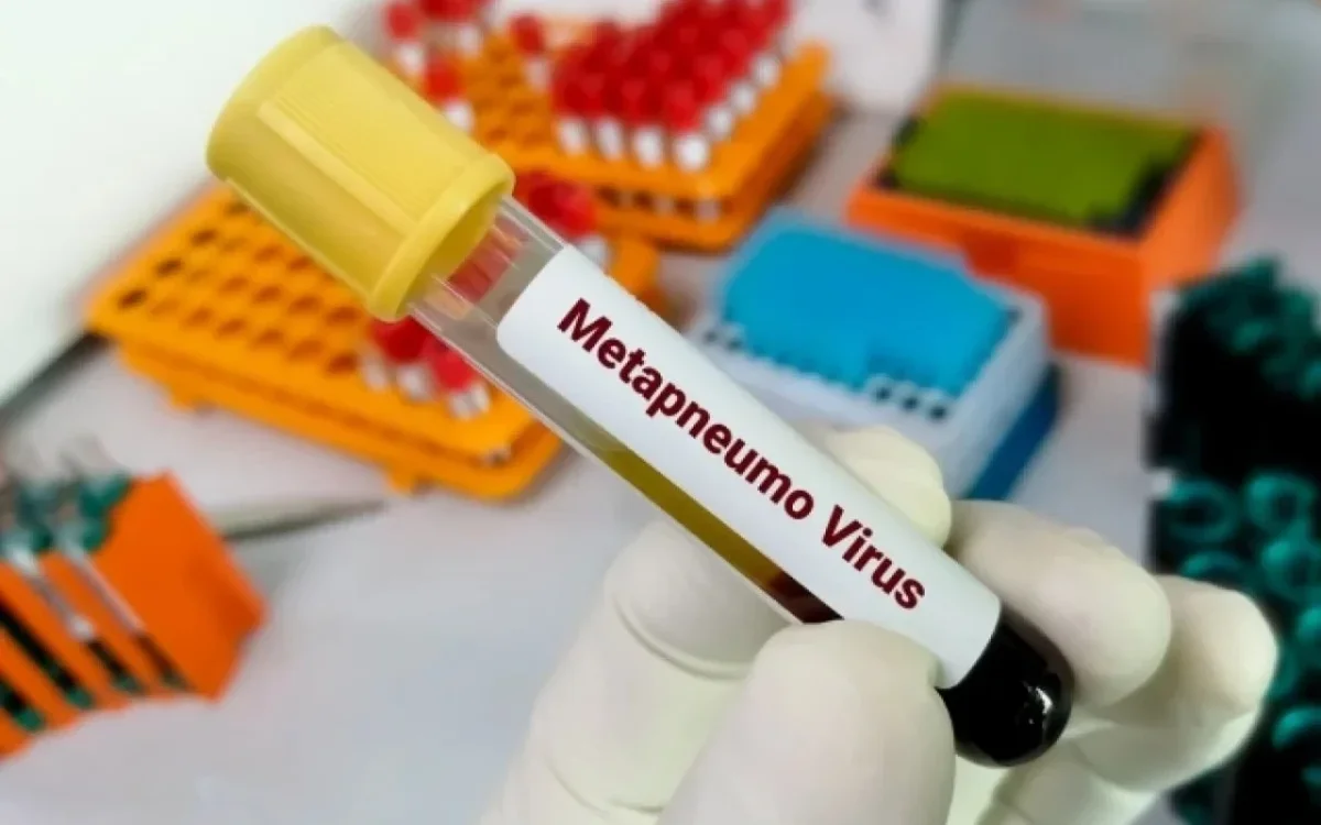 ÜSTdən metapnevmovirus AÇIQLAMASI