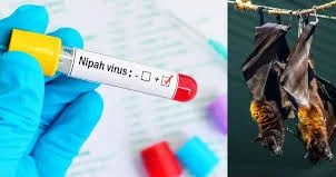 Nipah virusuna yoluxan tibb işçisi öldü