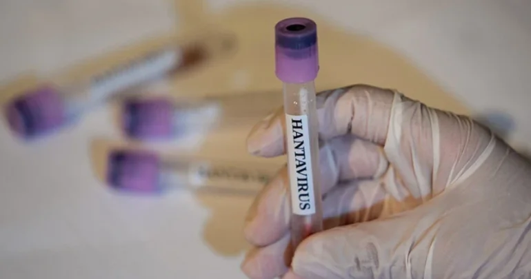 Hantavirus pandemiyaya çevrilə bilərmi?