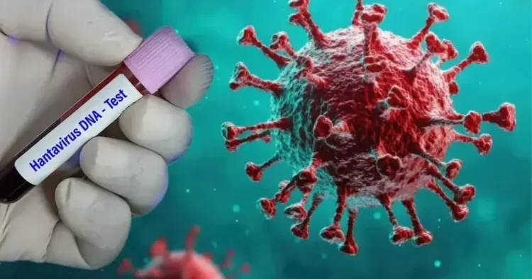 Hantavirus infeksiyası belə yaranır Həkim DANIŞDI