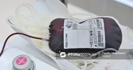 Службу крови в Азербайджане могут интегрировать в систему ОМС