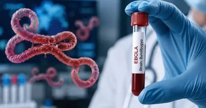 Konqoda yayılan Ebola ştamı artıq sərhədləri AŞIR