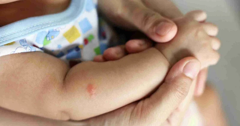 Valideynlər, diqqətli olun: Ağcaqanad dişləməsi uşaqlarda hansı xəstəliklərə yol açır?