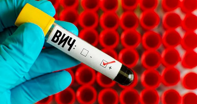 В прошлом году ВИЧ впервые был выявлен у 1 152 человек