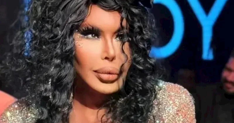 Bülent Ersoy estetik əməliyyatdan sonra yeni görünüşünü paylaşdı FOTO