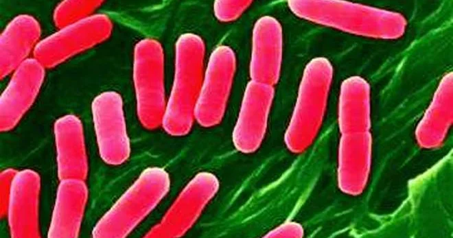 Antibiotiklərin çoxu bakterial infeksiyalara qarşı effektivliyini itirib ÜST